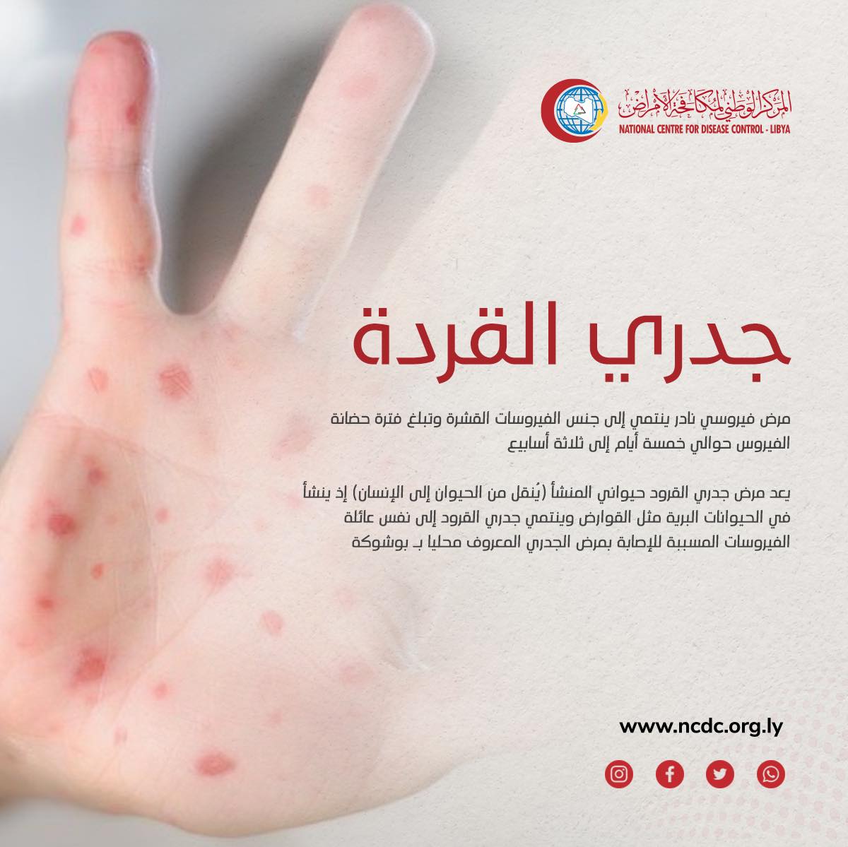Le CNCM confirme que le pays est exempt de toute infection par le virus monkeypox.