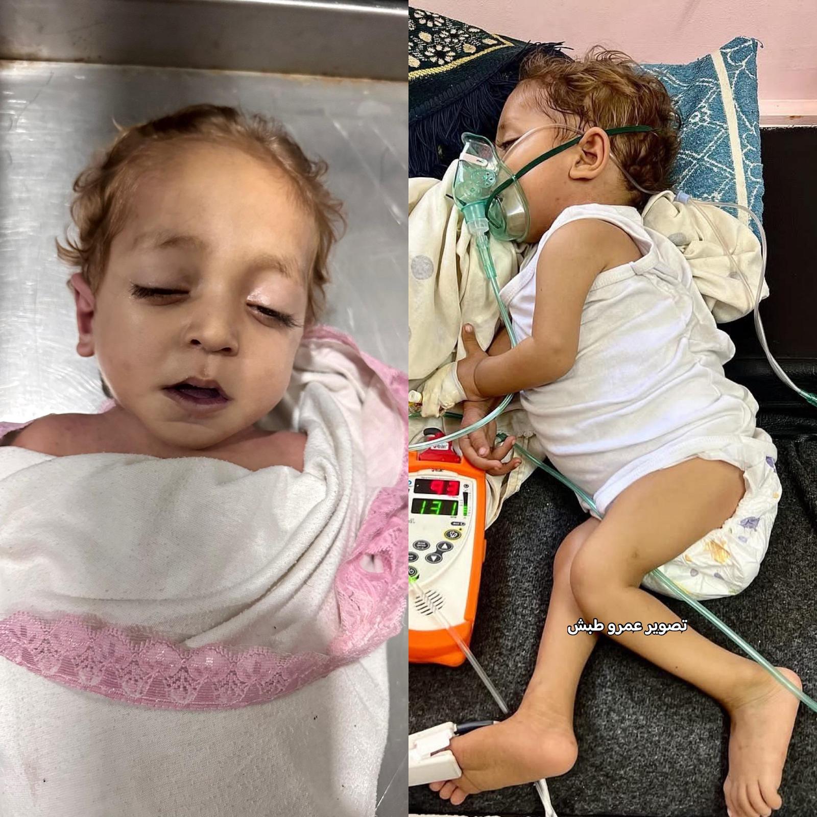 وفاة طفل في غزة جراء نقص العلاج وانهيار القطاع الصحي المحاصر. 
